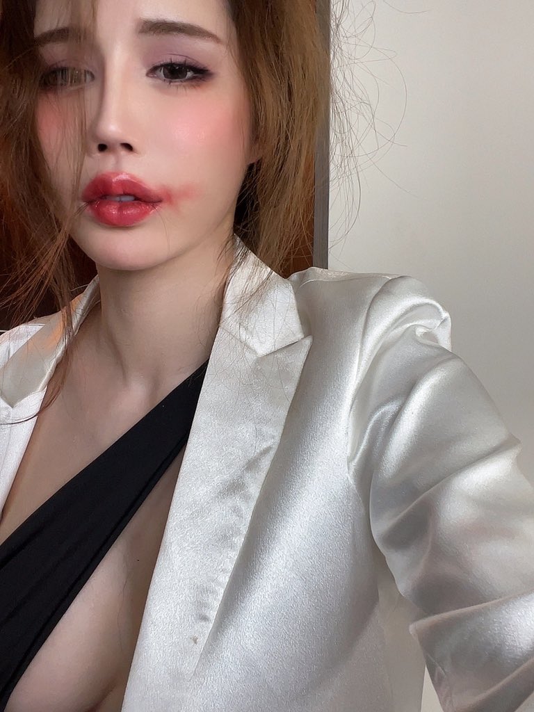 被咬了｜媒体1